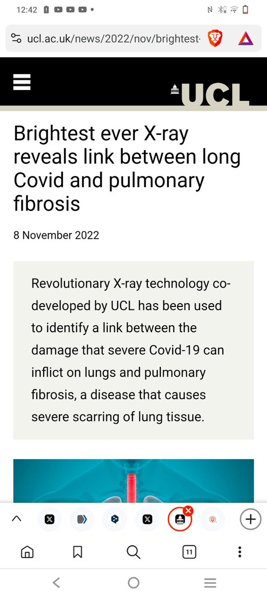 Woodynist's tweet image. 4/4 #Fibrosis &amp;amp; #netosis

#VitaminD has interesting protective properties in these fields, TOO.

Conclusion:  No surprise that vitamin D deficiency leads to serious outcomes. 
The sad thing is that @WHO as well as public health authorities can&apos;t ignore this.
Why don&apos;t they act?