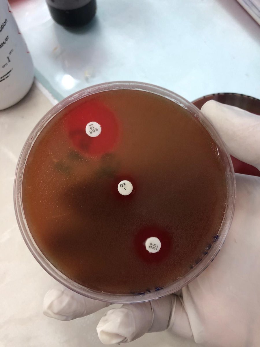 GSSHealth's tweet photo. GSSHealth recently facilitated a training in Togo to enhance laboratory professionals' technical capacities to detect bacterial #meningitis and #drugresistance. Thank you to our collaborators for making this workshop possible! #globalhealth #diseasecontrol #laboratorymedicine https://t.co/OT9nGpVT7b