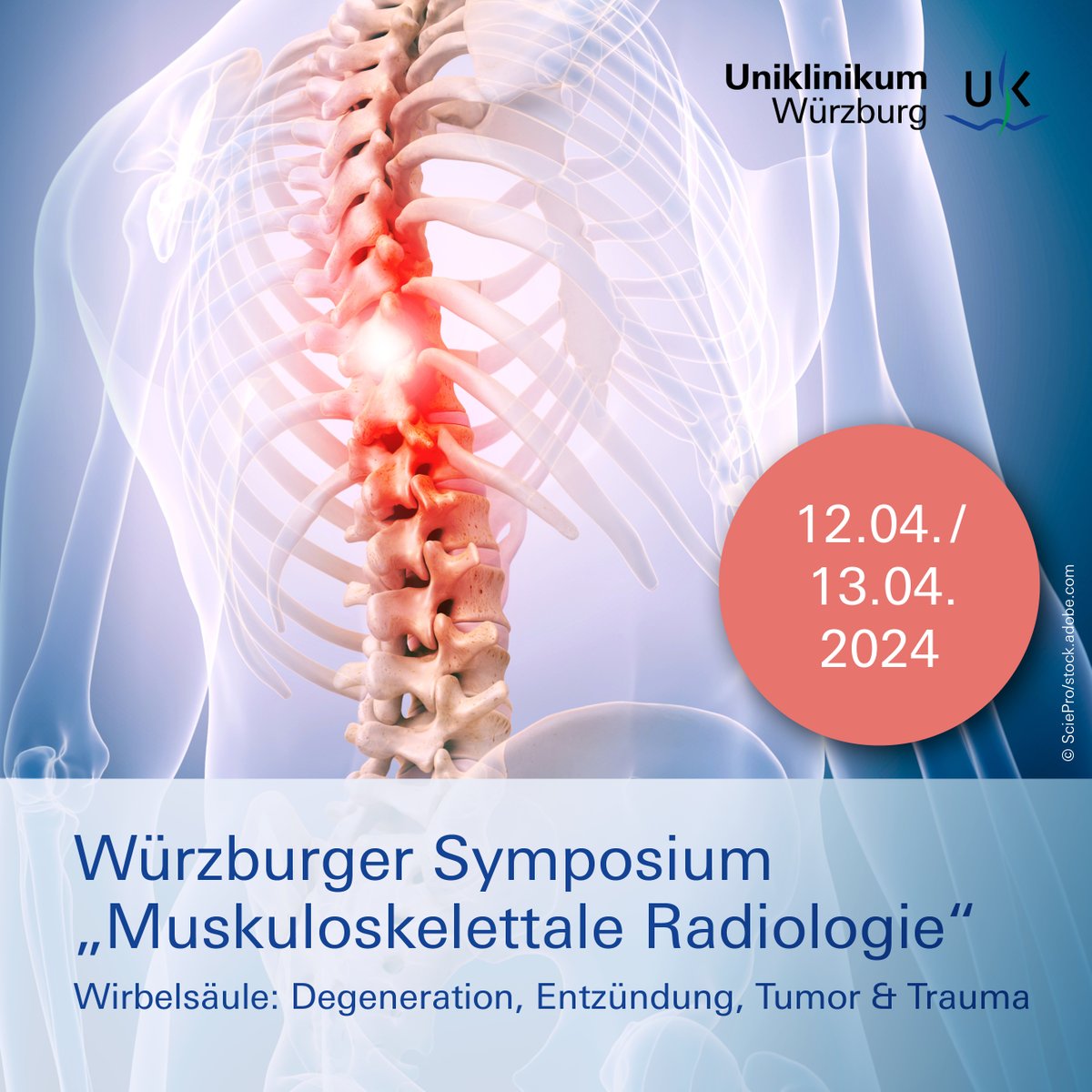 Einladung: 3. Würzburger Symposium „Muskuloskelettale #Radiologie“ mit dem Schwerpunkt #Wirbelsäule. Programm, Vortragende & Anmeldemöglichkeit: ukw.de/fileadmin/uk/r…