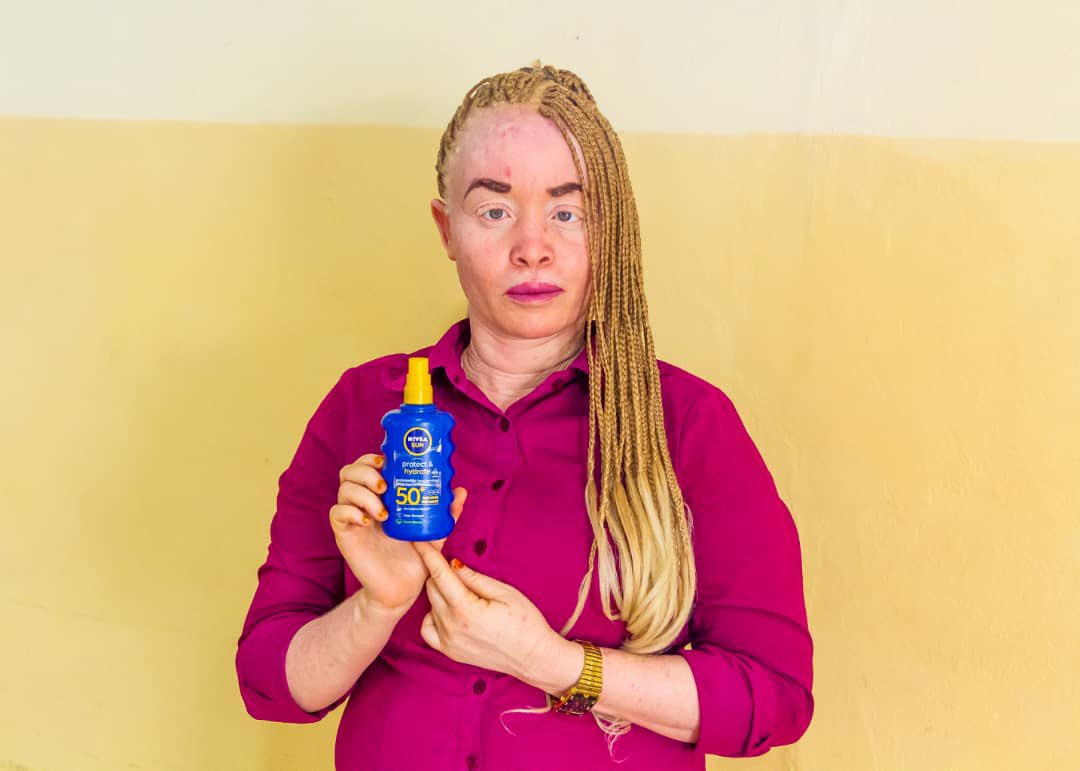 Together, let's support individuals with albinism. You can donate these products or contribute financially directly to any of these addresses or contribute to our GoFundMe page by clicking on this link: [gofund.me/1329d096].  

#andikamagazine #Burundi #africa #albinism