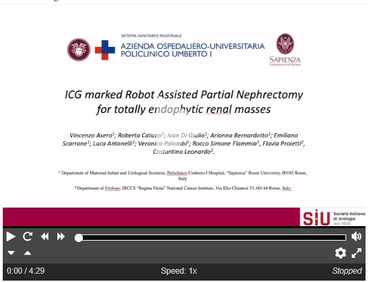 Check out this recently published article from Urology Video Journal ICG marked robot-assisted partial nephrectomy for totally endophytic renal masses Read now: spkl.io/60174I18X