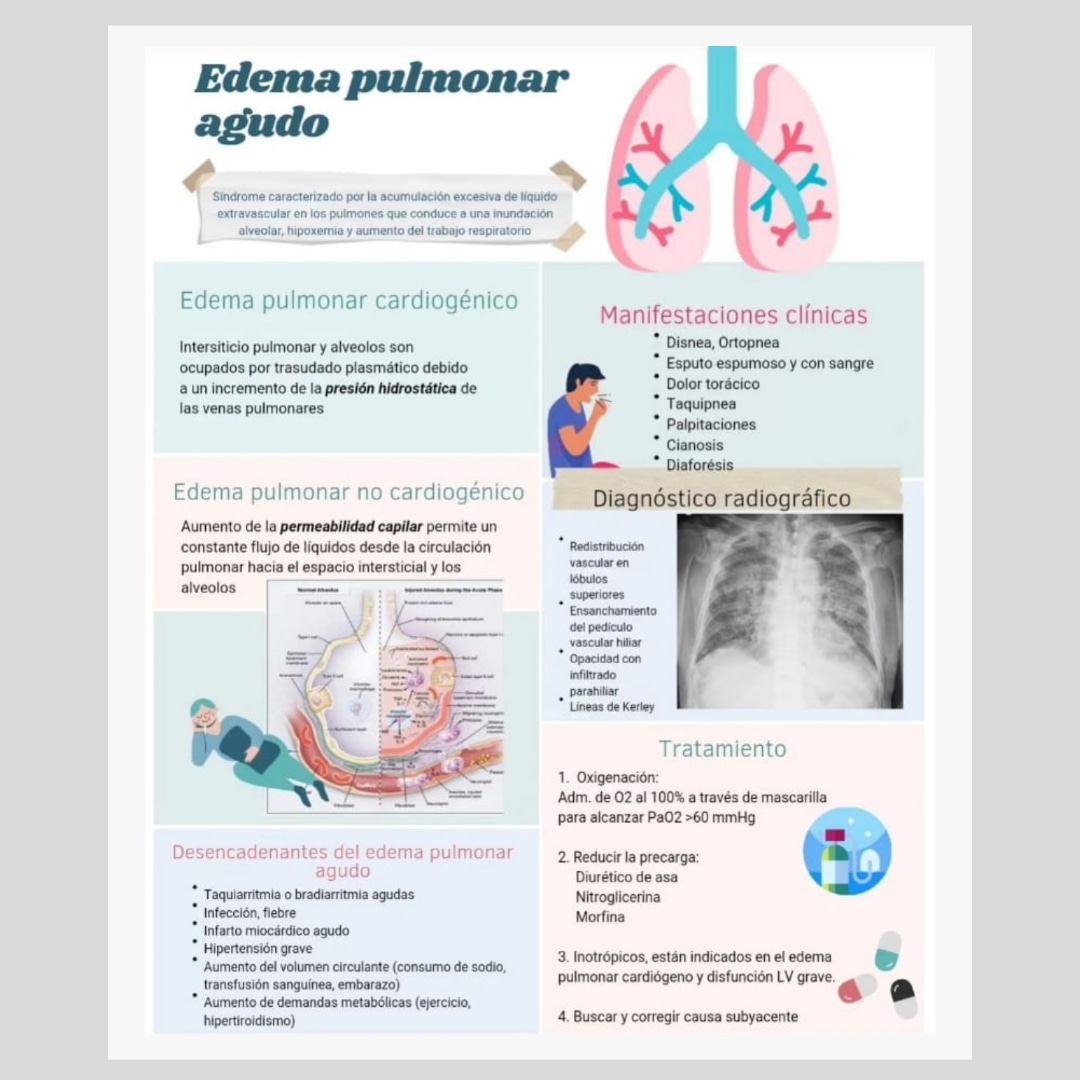 El #edemapulmonaragudo es una condición médica grave en la que se acumula líquido en los pulmones dificultando la respiración. Puede ser causado por insuficiencia cardíaca, lesiones pulmonares o problemas renales.
Infografía @conceptosmedicina 
#cursosonline #formacionsanitaria