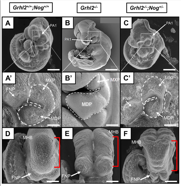 Development (@dev_journal) on Twitter photo Grainyhead-like 2 interacts with noggin to regulate tissue fusion in mouse
Read this #OpenAccess Research Report from Michael de Vries <a href="/DrMdeVries/">Michael de Vries</a>, Sebastian Dworkin <a href="/DworkinSeb/">Seb Dworkin</a> and colleagues
journals.biologists.com/dev/article/15… Grainyhead-like 2 interacts with noggin to regulate tissue fusion in mouse
Read this #OpenAccess Research Report from Michael de Vries <a href="/DrMdeVries/">Michael de Vries</a>, Sebastian Dworkin <a href="/DworkinSeb/">Seb Dworkin</a> and colleagues
journals.biologists.com/dev/article/15…