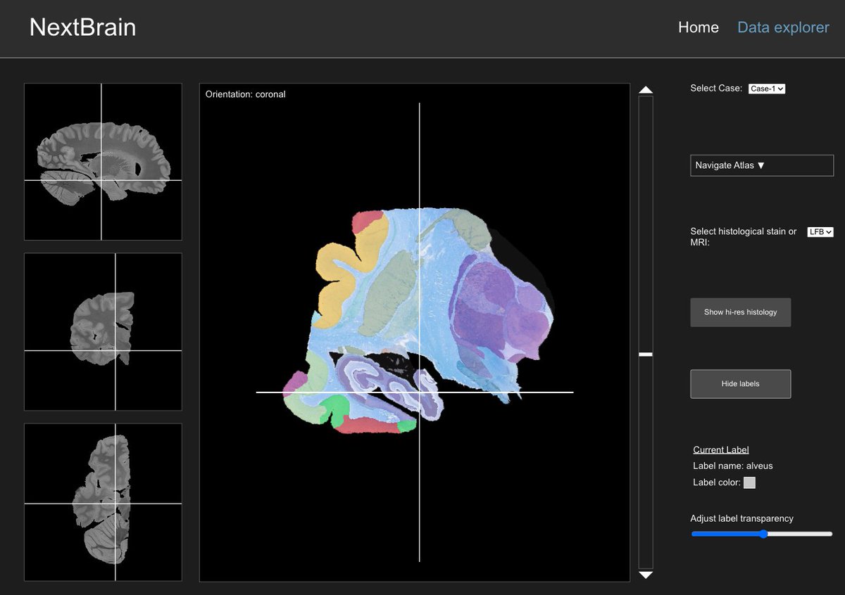 New video with a short tutorial on the Data Explorer of NextBrain: youtube.com/watch?v=pVOfxi… (thanks Jon Williams-Ramirez for the narration!) Preprint, data, code, other videos, and much more at: github-pages.ucl.ac.uk/NextBrain