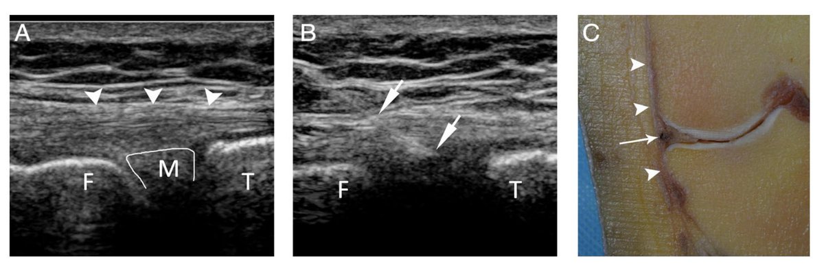 Sᴡɪss Uʟᴛʀᴀsᴏᴜɴᴅ Cᴇɴᴛᴇʀ - UZR tweet media