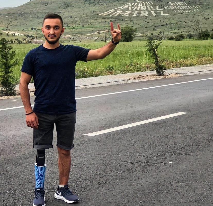 Kayseri 1.Komando Tugay Komutanlığı’nda görevliyken 2016 yılında uğradığı saldırıda bacağını kaybeden Ferdi ÇATAL’a 58 bin TL tazminat ödenmişti.

Mahkeme 2024 yılında bu paranın 35 bin TL’sinin iade edilmesini istedi.

Ferdi ÇATAL bacağını kaybettiğinde “Bir bacağım değil bin