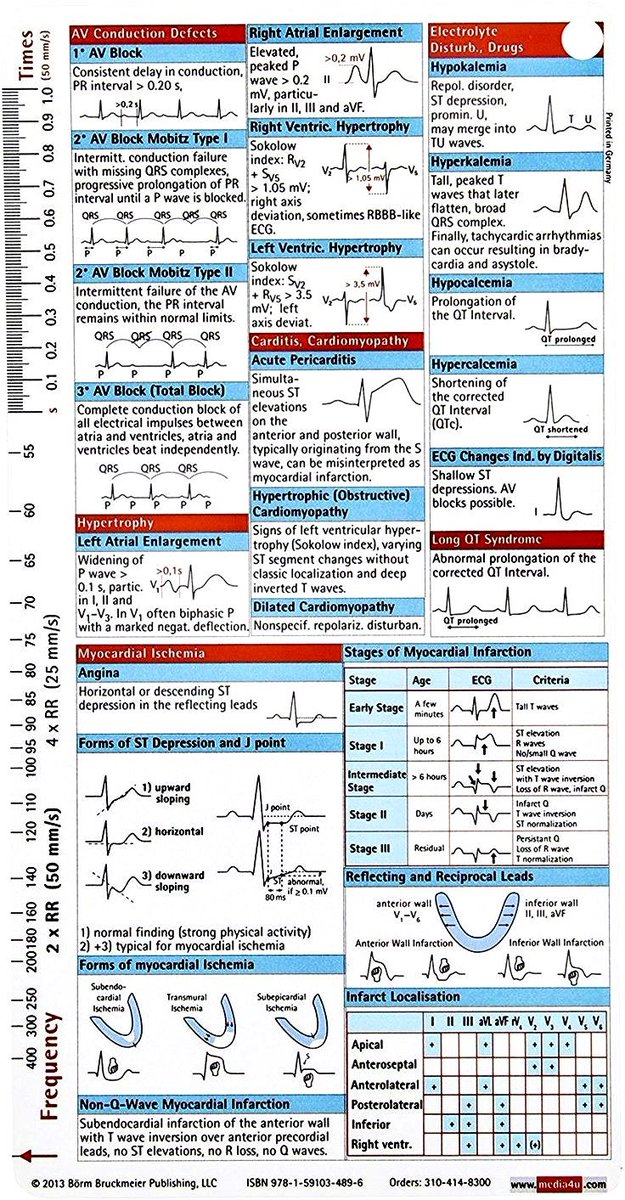 Important ECG concepts: