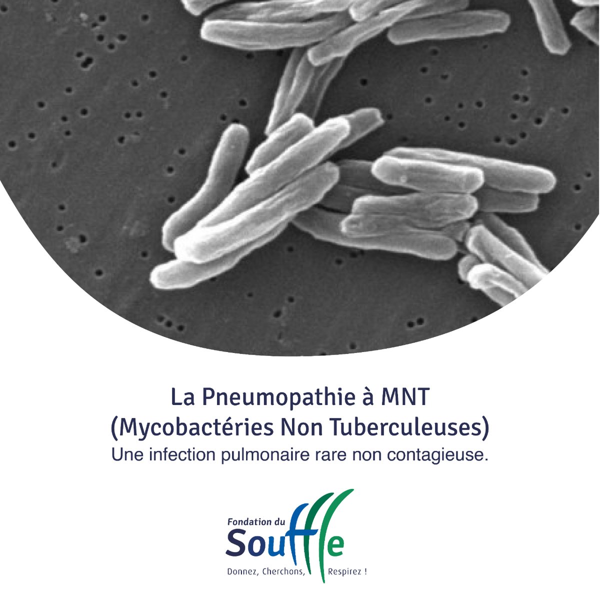 🌟 Aujourd'hui, nous mettons en lumière l'Association "MNT Mon Poumon Mon Air", qui vient en aide aux personnes atteintes de l'infection pulmonaire à Mycobactéries Non Tuberculeuses (MNT).

Notre article sur la Pneumopathie à MNT : lesouffle.org/mycobacteries-…