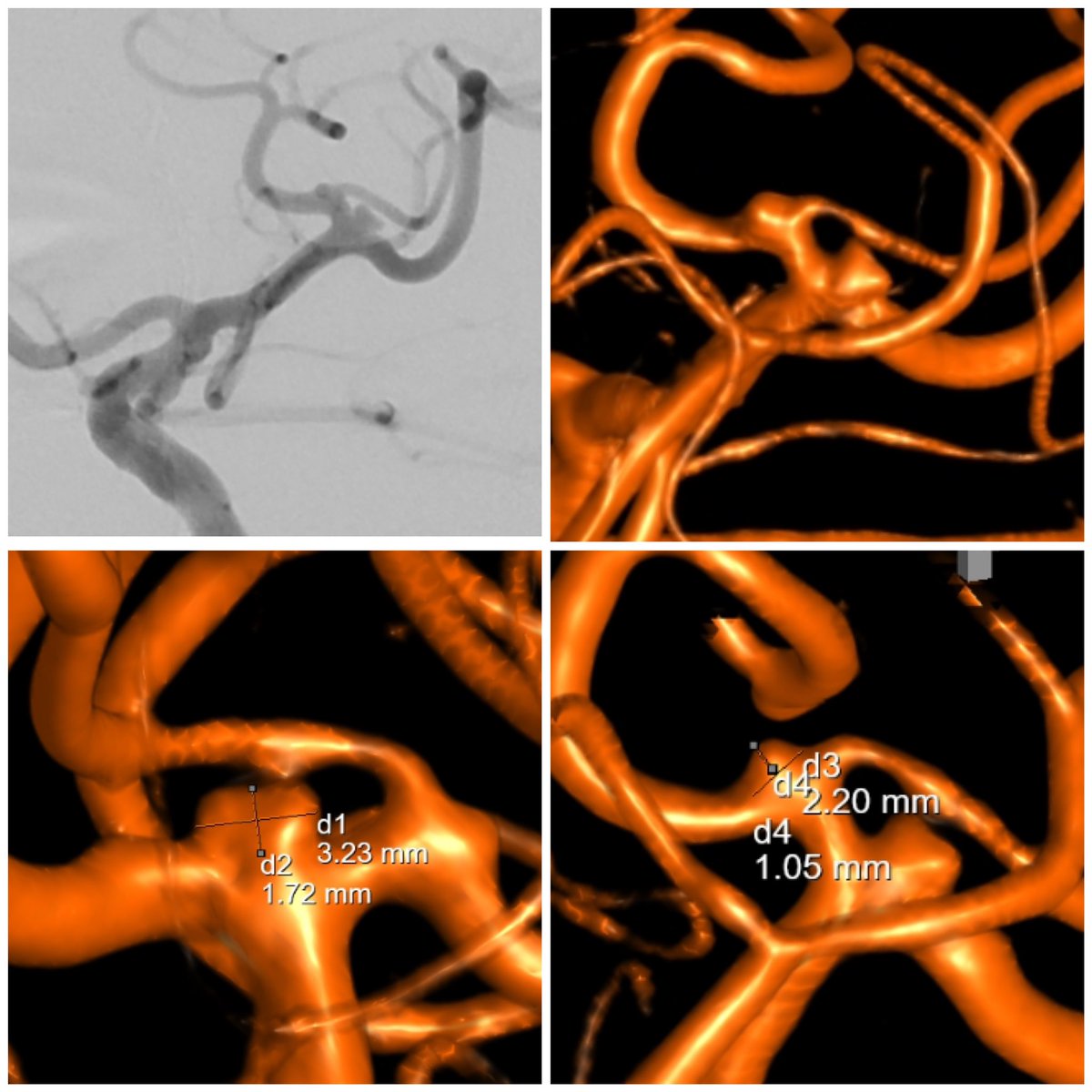 Jan-Karl Burkhardt, MD tweet media