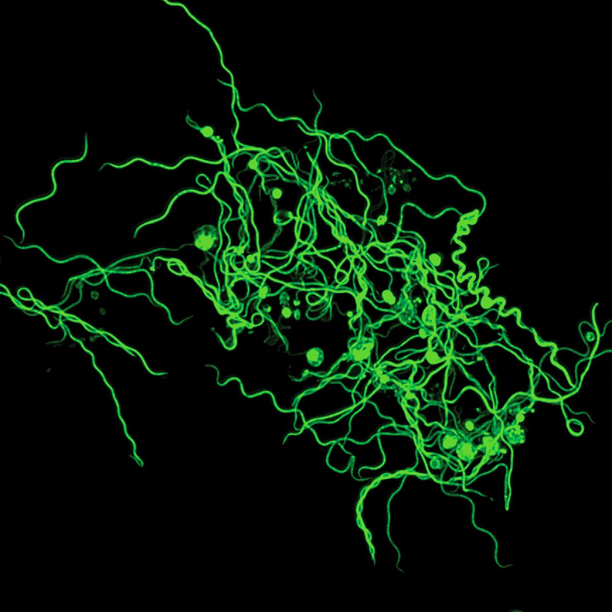 Not only does this article connect the immune dysregulations of #LongCovid & #ChronicLyme, but this is also the most beautiful stain of Borrelia burgdorfi I've ever seen. Thank you @ImmunoFever.

technologyreview.com/2024/02/28/108…

Image: Tal Research Lab