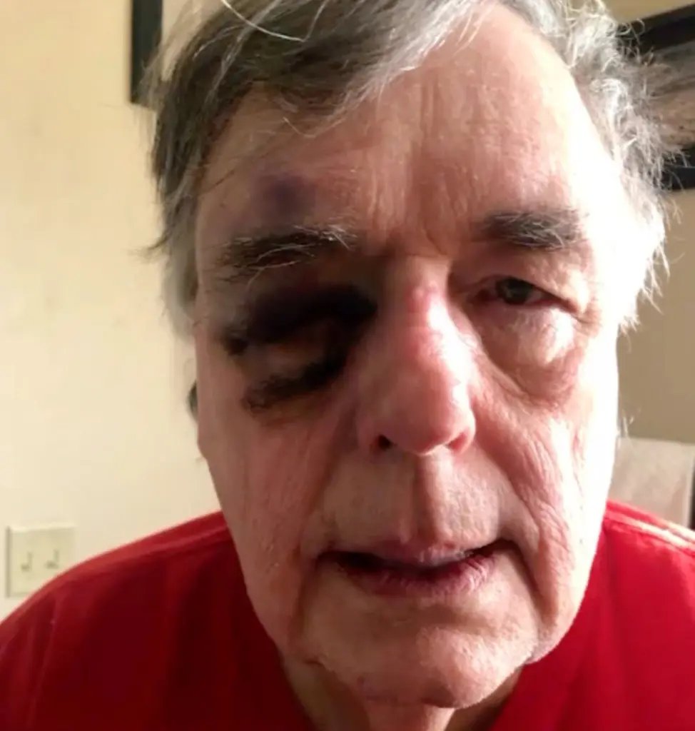 CollinRugg's tweet image. JUST IN: Substitute elderly teacher beaten by 280-pound student at Perry Meridian High School in Indianapolis.
Authorities have launched an investigation after 74-year-old substitute teacher Rob Gooding was allegedly beaten with a Chromebook.
The student was described as aโฆ
