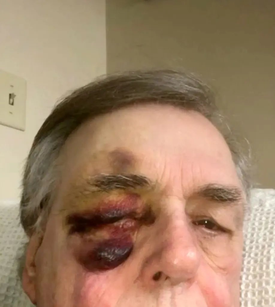 CollinRugg's tweet image. JUST IN: Substitute elderly teacher beaten by 280-pound student at Perry Meridian High School in Indianapolis.
Authorities have launched an investigation after 74-year-old substitute teacher Rob Gooding was allegedly beaten with a Chromebook.
The student was described as aโฆ