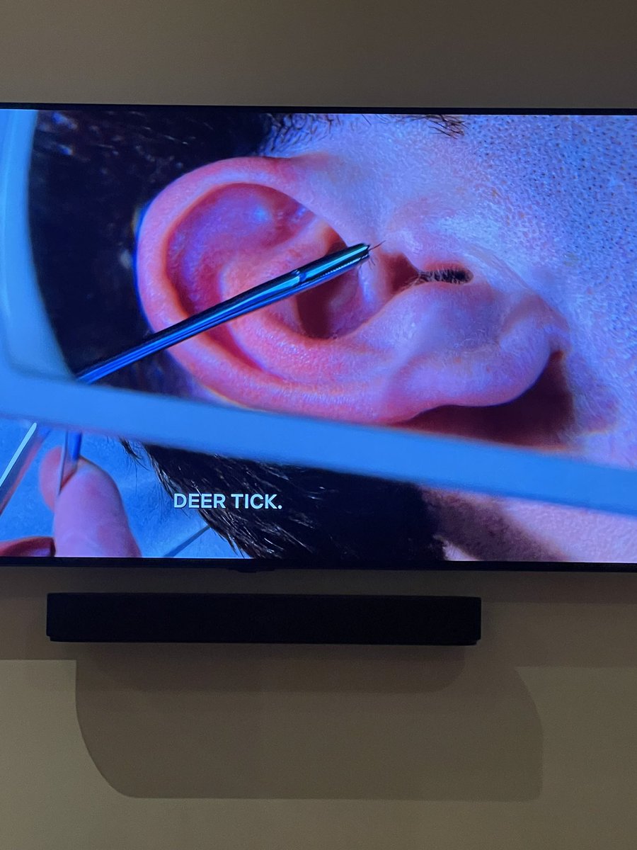 That time on Royal Pains (Netflix) when suddenly the doc pulled a blacklegged #tick out of a guy’s ear, saving the patient’s future football career! 🤪