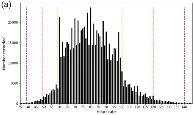 Nurses knew this already but...

We've managed to show that clinicians use their discretion when recording vital signs near escalation triggers

Our new paper just dropped (link in 🧵)