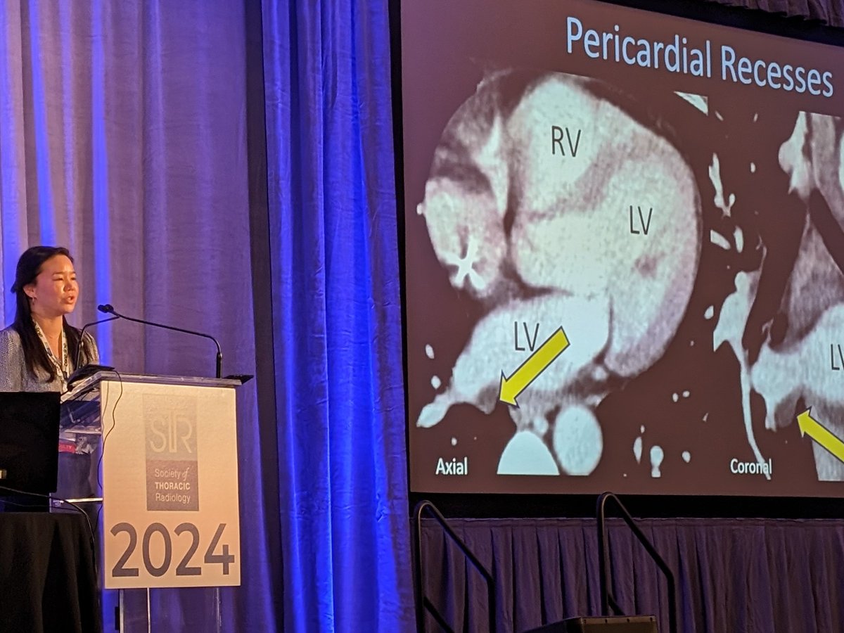 Katherine Cheng, MD giving penultimate lecture at #STR2024.
<a href="/DukeRadiology/">Duke Radiology</a>