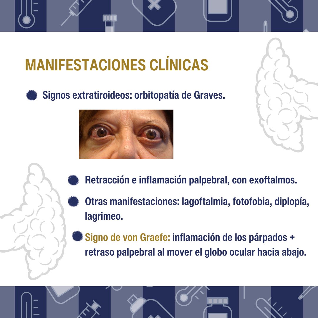 Aesculapyus_MD's tweet photo. Repasa Enfermedad de Graves para el ENARM 2024 #ENARM #MIR https://t.co/o0SShYZICg