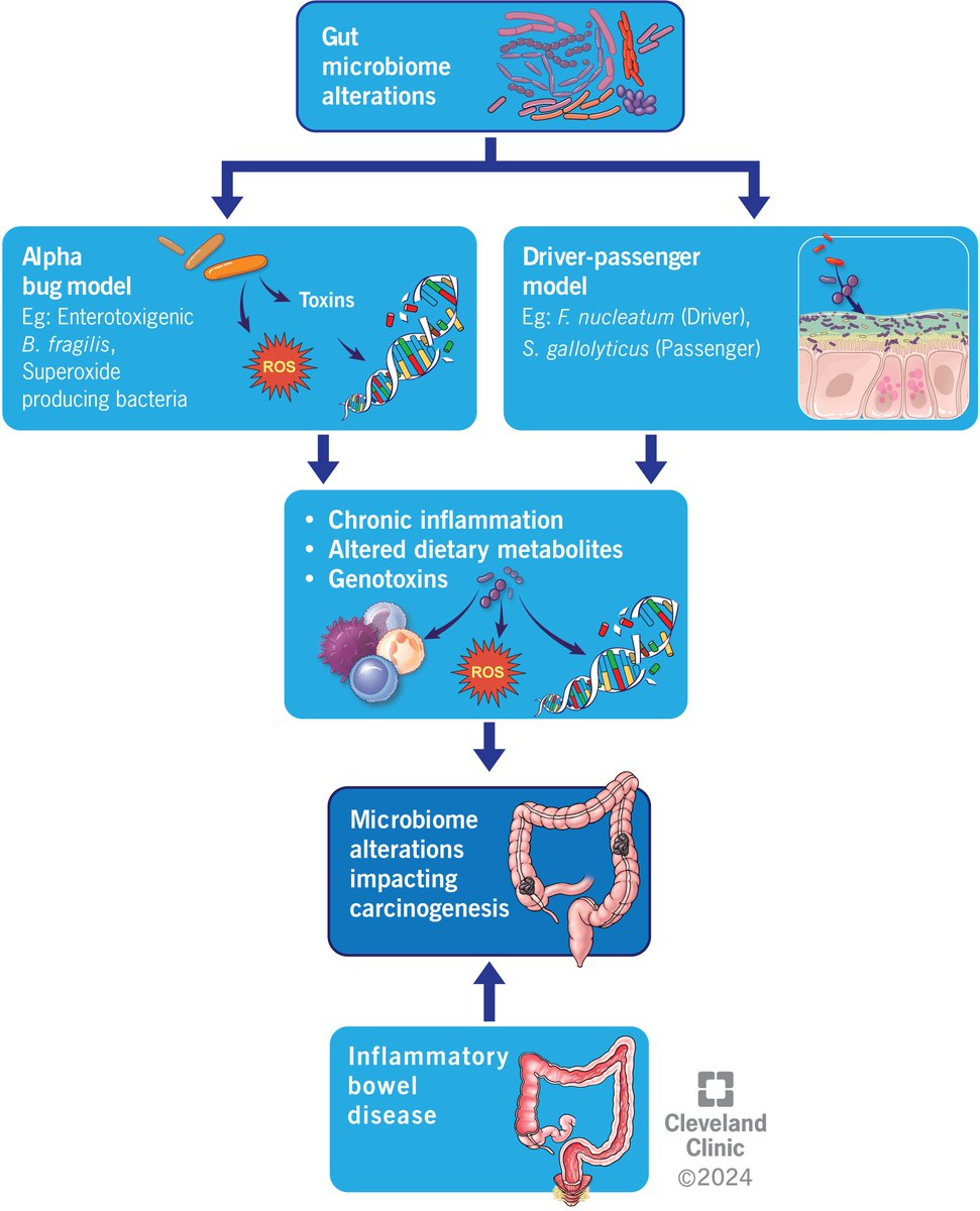 Rx_Devvrat's tweet image. Check out our article on the dynamic interplay of gut bacteria and colorectal cancer (CRC)! 🦠:
-Mechanism on how the microbiome prevents/promotes oncogenesis
-Bidirectional relationship of oncotherapy and microbiome
-Role of FMT in treating CRC 
doi.org/10.3390/microo…