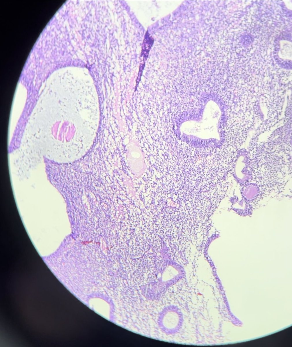 Housna_Labed's tweet photo. 😍
#pathology #pathologist https://t.co/qs0gsRnlCE