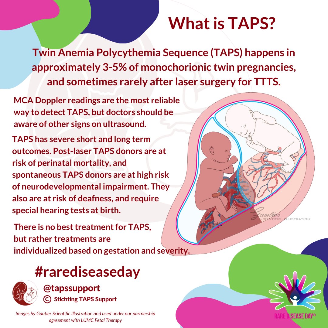 Let's start with TAPS.  This rare disease happens in around 3-5% of monochorionic twins, and sometimes, after laser surgery for TTTS.  Learn more on our website: bit.ly/3mG2OCy

#rarediseaseday #raretwins #ttts #taps #sfgr #trap #tapssupport