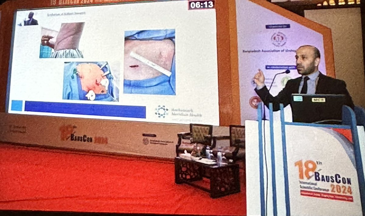 Fahad Sheckley (@fsheckley) on Twitter photo Great honor presenting our work at Bangladesh Association of Urologic Surgeons #BAUS
Thanks to the great opportunity provided at <a href="/HUMCUrology/">HackensackUMC Department of Urology</a> to send me to Dhaka <a href="/mdstifelman/">Michael Stifelman</a> <a href="/RoboticsUrology/">Mutahar Ahmed</a> Great honor presenting our work at Bangladesh Association of Urologic Surgeons #BAUS
Thanks to the great opportunity provided at <a href="/HUMCUrology/">HackensackUMC Department of Urology</a> to send me to Dhaka <a href="/mdstifelman/">Michael Stifelman</a> <a href="/RoboticsUrology/">Mutahar Ahmed</a>