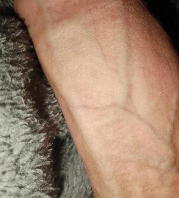 veins veins https://t.co/S4N16TcJkW