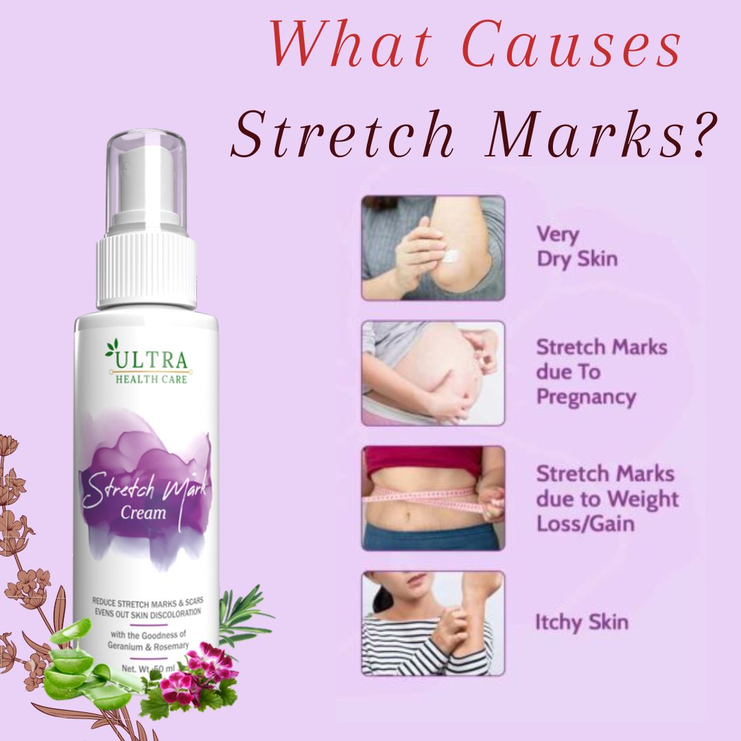 🌟 Discover a natural solution to stretch marks with our organic skincare products! Formulated to leave your skin smooth and radiant. Try it today!

For more info 𝗖𝗟𝗜𝗖𝗞 𝗡𝗢𝗪:- bit.ly/3UXWVDB

#ultrahealthcare #stretchmarkscream #organicbeauty #StretchMarkSolution