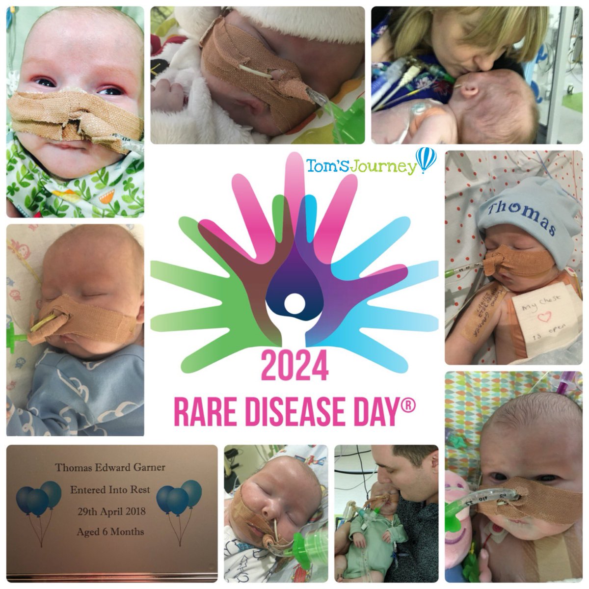On Rare Diseases Day 2024, I’d like to raise awareness of 22q11.2 Deletion Syndrome. If you do nothing else for  #RareDiseaseDay2024 today, please give this a share…let’s #RaiseAwareness on todays #LeapYear, and get #DiGeorgeSyndrome out there in Thomas’ memory. 

Otherwise