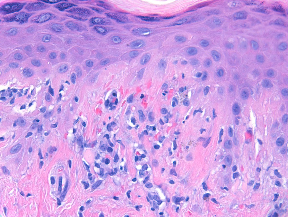 Richard Carr tweet media