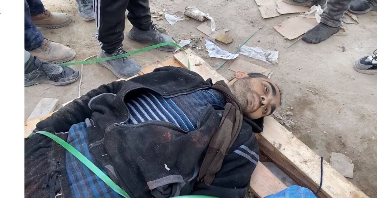 BREAKING| Scenes of casualties following an Israeli massacre, which targeted thousands of hungry people at Al Rasheed Street in northern Gaza this morning. 

According to medical sources, the victims were targeted in their heads and chests, which indicates that Israeli forces