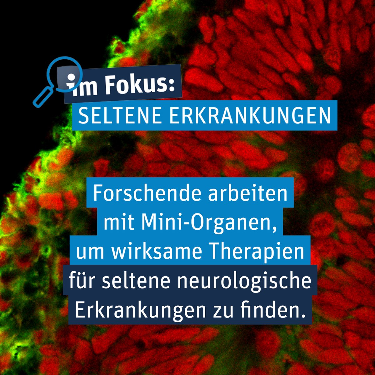 Mit Hirnorganoiden werden neue Wirkstoffe zur Therapie von seltenen neurologischen Erkrankungen @uni_tue & @KITKarlsruhe getestet. Klicke hier, um mehr über #Forschung auf diesem Feld zu erfahren ⬇️ vfa.de/orphan-drugs-m… #RareDiseaseDay #StandUp4Rare