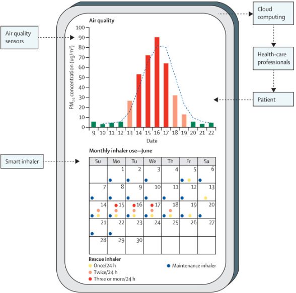 NEW Viewpoint: Remote digital health technologies for improving the care of people with respiratory disorders. @StevenSteinhubl @drjessilyn @AndreaCoravos @PersonalizedMed @fanarjian Read it here: buff.ly/3Ik35Xs