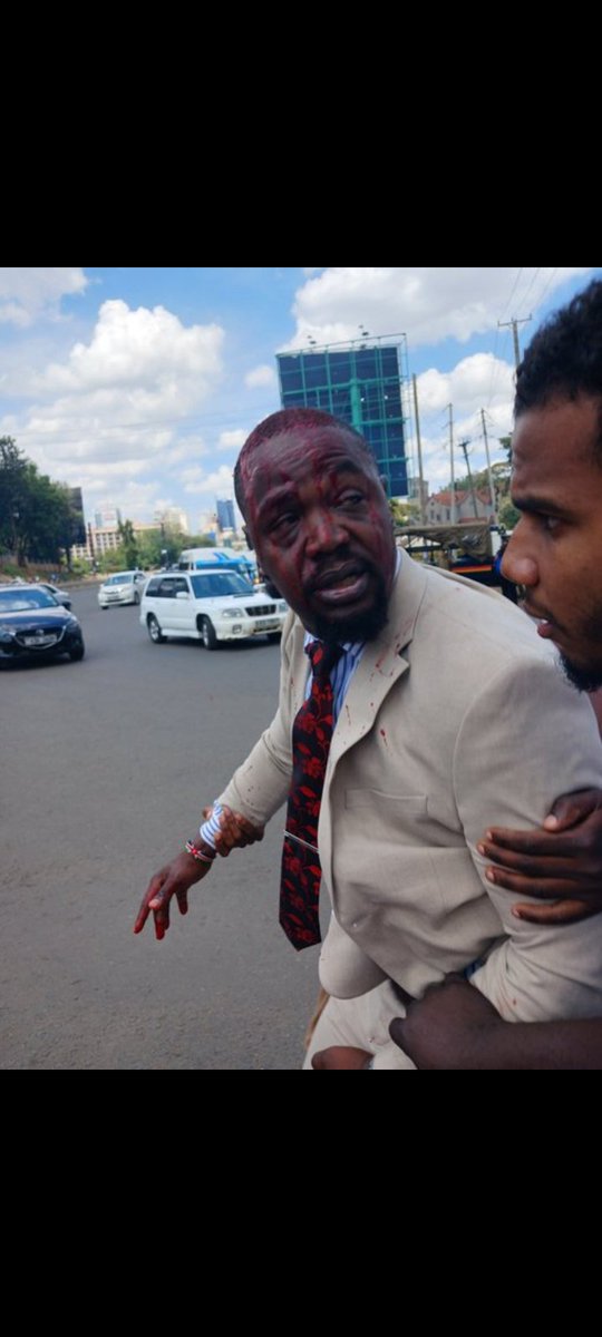 We strongly condemn the injuring of the SG of @kmpdu while participating in a peaceful protest. @Davji and every other Kenyan have the right to engage in a peaceful protest. We demand that the police and every other stakeholder involved in public order to respect the constitution