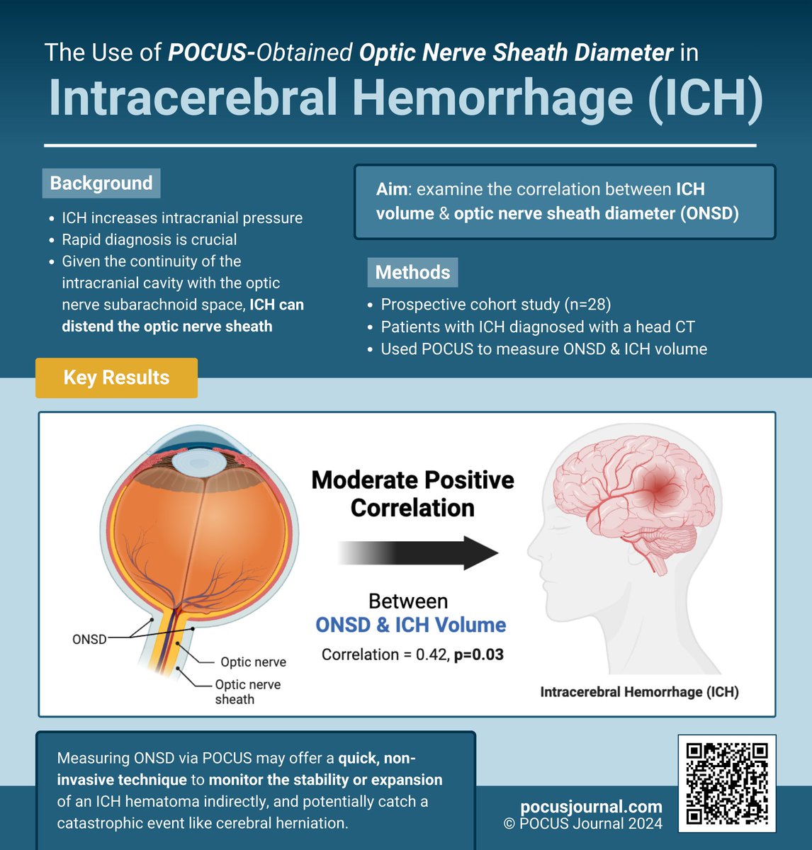 💡Optic nerve sheath diameter may be an indirect predictor of intracerebral hemorrhage volume 👁➡️🧠

🔗 doi.org/10.24908/pocus…

Thoughts? 👇
#POCUS #FOAMed #MedEd #MedX #EmergencyMedicine