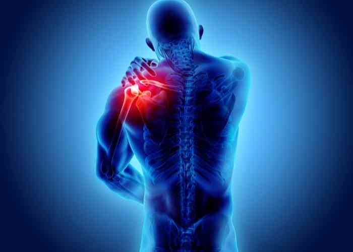orthopatelmd's tweet image. Ever wondered how an open #Latarjet procedure is performed?

Dr. Patel makes an incision over the front of the shoulder to access the joint. Studies show better #shoulderstability &amp;amp; improved Rowe scores over time. Here is why: medilink.us/f9le  #LatarjetProcedure