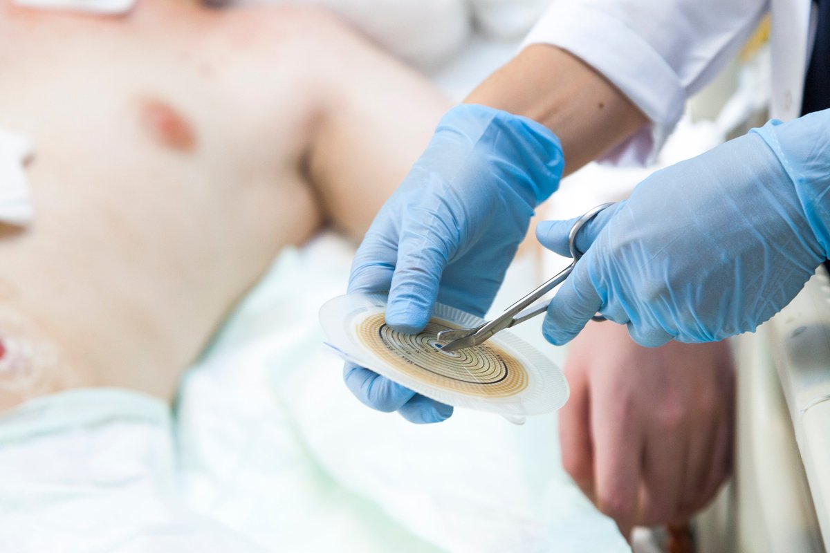 In our blog about stoma care services and the Hub’s frameworks supporting them, charity @iasupport reminds us, for ostomates ‘every experience is different’ and ‘stoma care needs to be tailored to each individual patient.’ Full story on our blog: bit.ly/424Kkju.