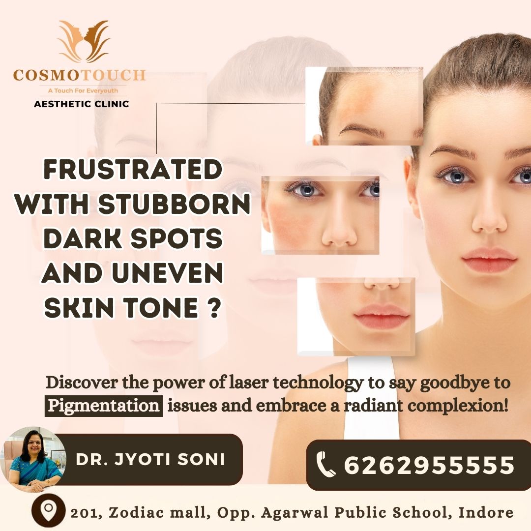 Are you frustrated with stubborn #darkspots and uneven #skintone? Wondering if there's a solution to say goodbye to #pigmentation issues?

Call us for free consultation 6262955555

#skincare #skincareroutine #darkcircles #darkcirclesolutions #laser #indorelasertreatment