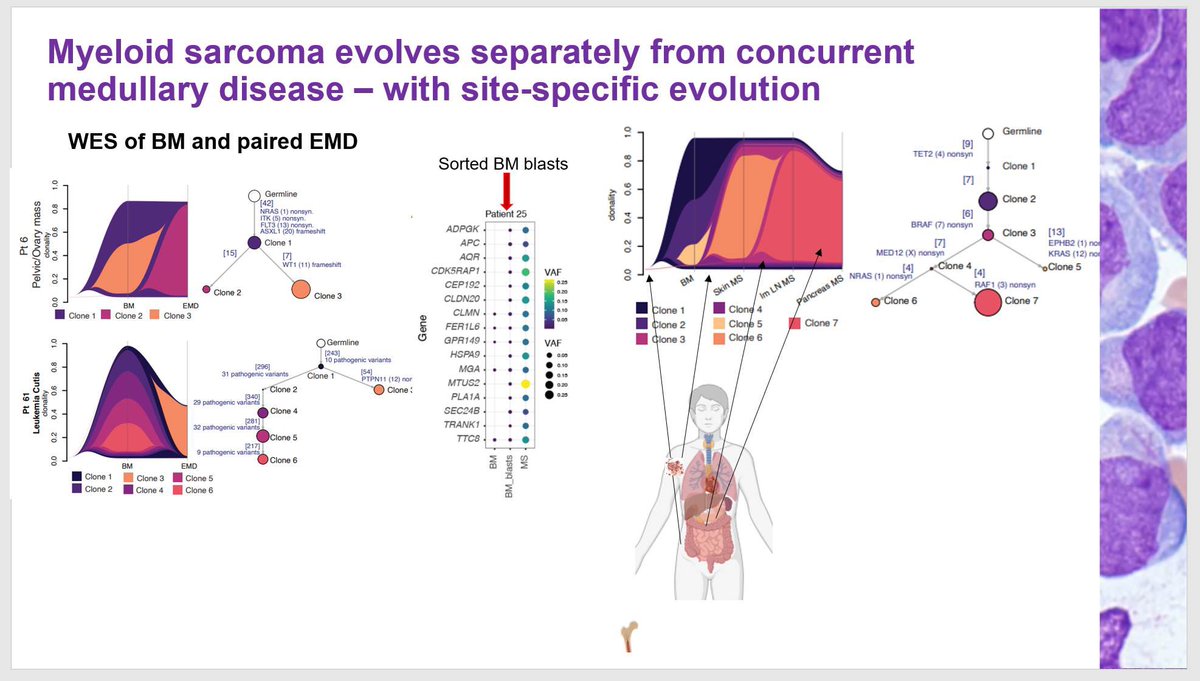 Sanam Loghavi, MD صنم لغوی 🔬🧬 (@sanamloghavi) on Twitter photo Thank you <a href="/AkEisfeld/">AK Eisfeld</a> for visiting <a href="/MDAndersonNews/">MD Anderson Cancer Center</a> .. for your outstanding talk on myeloid sarcoma and for sharing your beautiful data with us.
Seeing this story come to life has been a true joy.
looking forward to ongoing and future exciting collaborations together. Thank you <a href="/AkEisfeld/">AK Eisfeld</a> for visiting <a href="/MDAndersonNews/">MD Anderson Cancer Center</a> .. for your outstanding talk on myeloid sarcoma and for sharing your beautiful data with us.
Seeing this story come to life has been a true joy.
looking forward to ongoing and future exciting collaborations together.