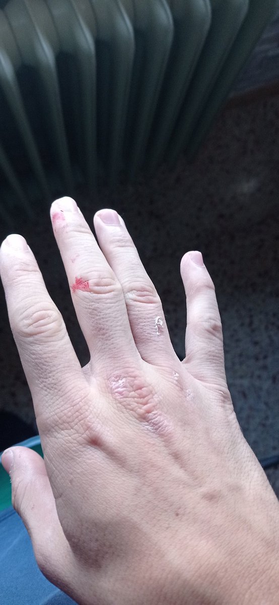 _Arnau_Ruiz_'s tweet image. Me he caído por las escaleras #notfunny