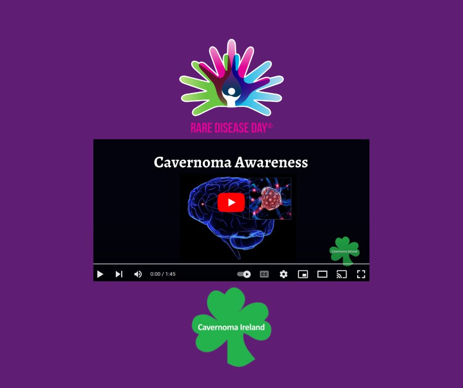 #RareDiseaseDay
Cavernoma - Awareness Video
👉youtube.com/watch?v=xuxKvX…

#Cavernoma #CavernousMalformation #CCM #FCCM #CavernomaAwareness
#RareDiseaseDay2024 #RareIsMany #RareIsProud #RareIsStrong

@rarediseaseday 
@rareireland @RareDiseasesIE @NI_RDP 
@naiireland @EuropeCavernoma