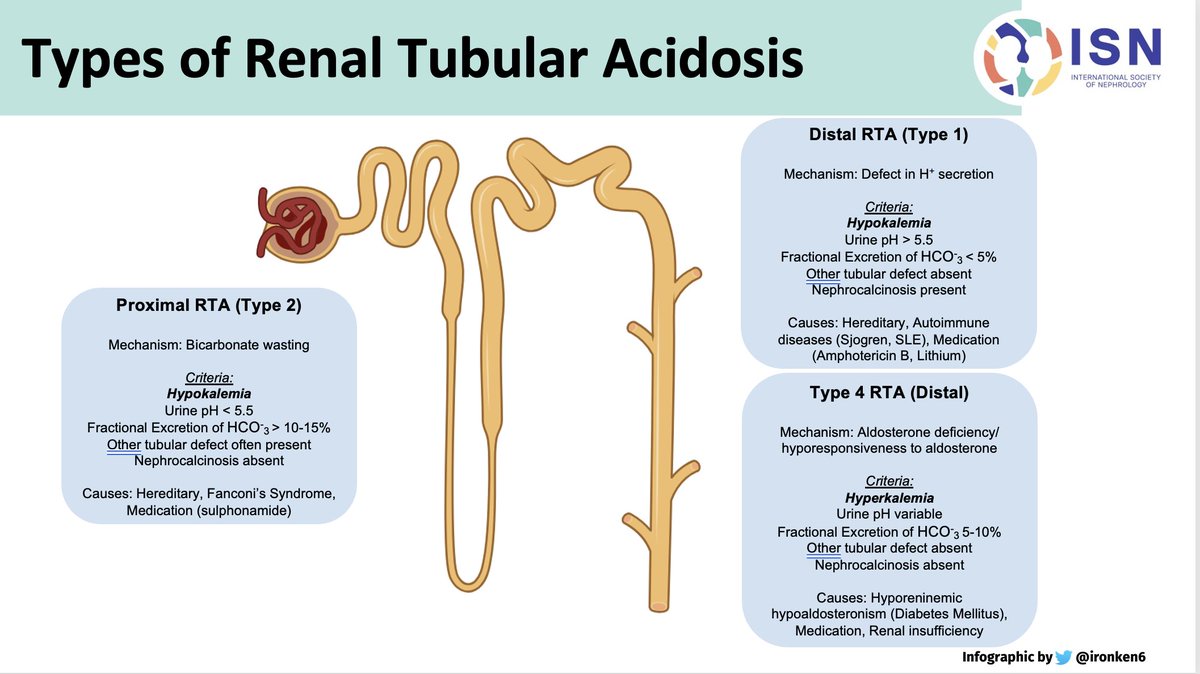 #ECNeph The much confusing RTA , features in a baeutiful infographic by @Ironken6 #ECNeph @dakidneydoc @ISNkidneycare @myadla