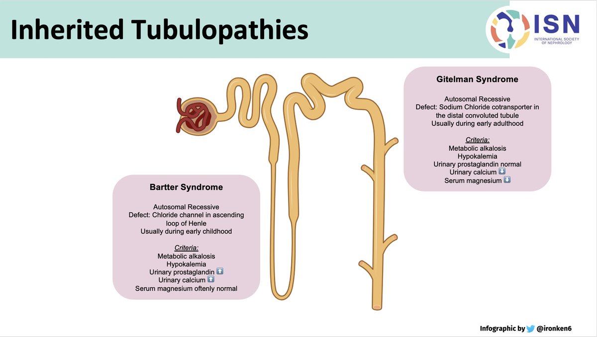 #ECNeph How to differentiate Bartters /Gitelmann In nut shell #ECNeph @dakidneydoc @ISNkidneycare @myadla