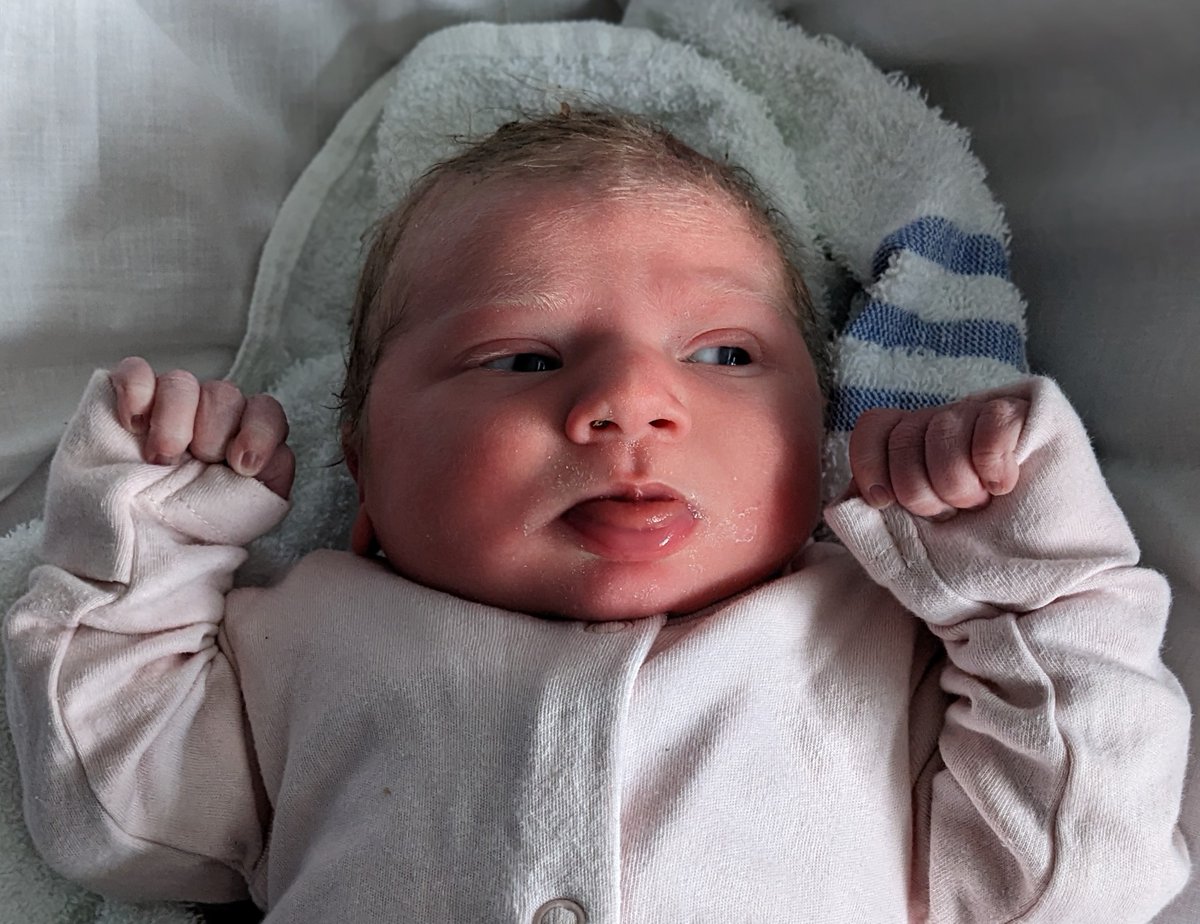 RoyalSurrey's tweet photo. Welcome to the world Leaplings!

Ivy, Rosa-Lynn and Iris are among the leap-year babies born today on our maternity ward  👶👶👶

Happy birthday to all the #leaplings and congratulations to everyone celebrating a new arrival today🎉

#RoyalSurrey https://t.co/DRxO3jYwNL