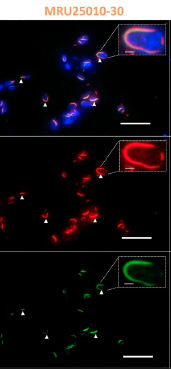 sfm_jm's tweet photo. Ce mois-ci, c’est @_Virotine qui vous propose l’article coup de ♥️ du ReJMiF : intéressons-nous au virus de la fièvre de la vallée du Rift, à travers le travail de @JordanQuellec 🔬. Pour y accéder, c’est par ici 👉: https://t.co/I4HaH6ohtM https://t.co/sPjaZnexHO