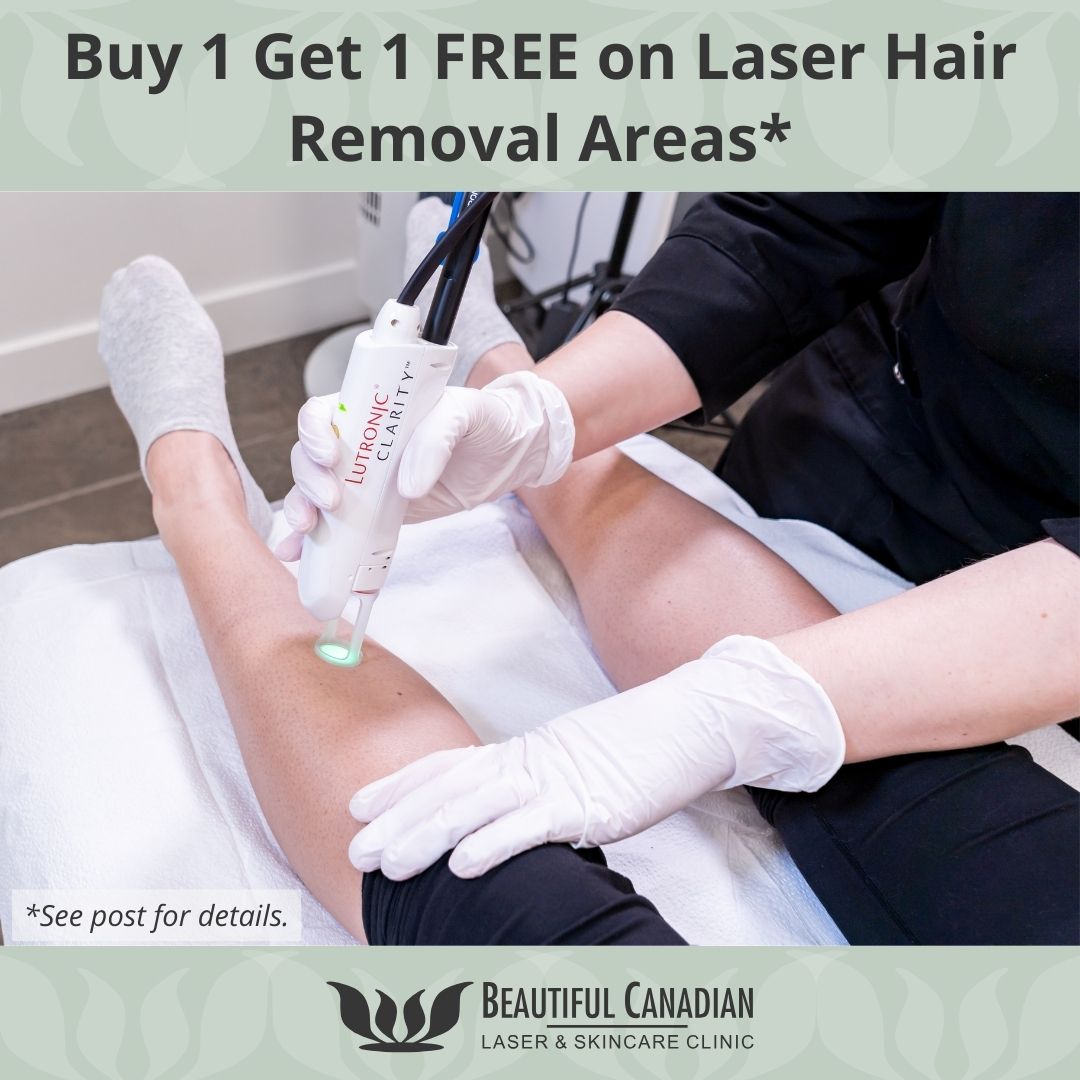 Buy 1 area, Get 1 area FREE* on Laser Hair Removal

CALL / TEXT 604 580 2464

l8r.it/FrtF

#laserhairremoval #hairremoval #vancouvermedspa #vancouverskinclinic #surreyskinclinic #surreymedspa #vancouverpromos #surreypromos

*Of equal or lesser value. Terms apply.
