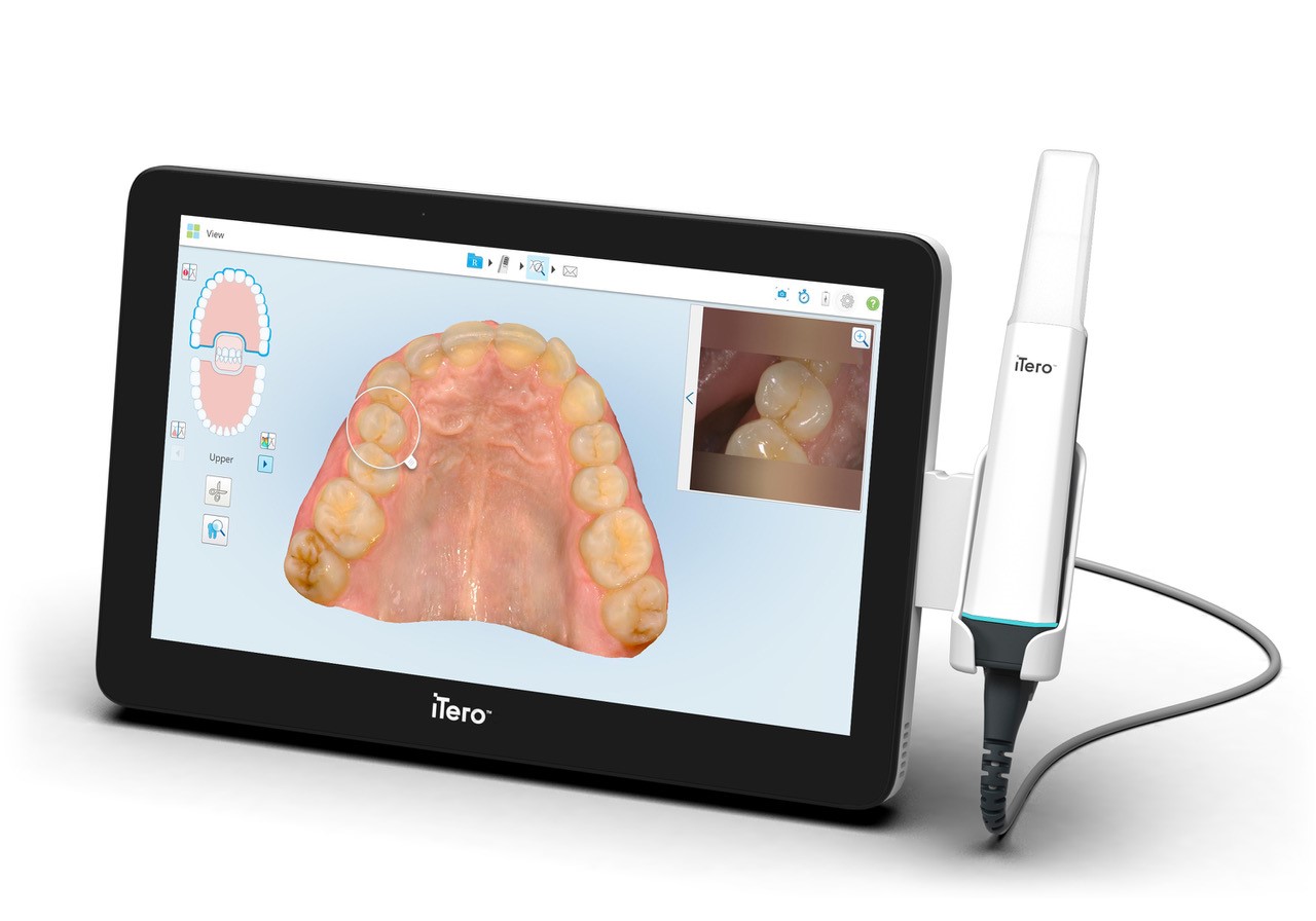 Align Technology Announces New iTero Lumina™ Intraoral Scanner Featuring a  3X Wider Field of Capture1 in a 50% Smaller Wand2 That Delivers Faster  Scanning, Higher Accuracy3, and Superior Visualization4 for Greater Practice