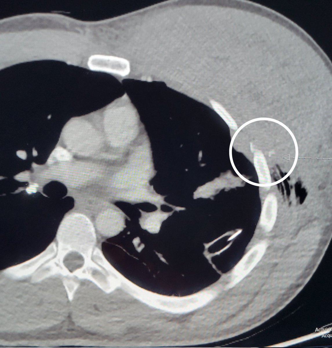 Temple Radiology tweet media