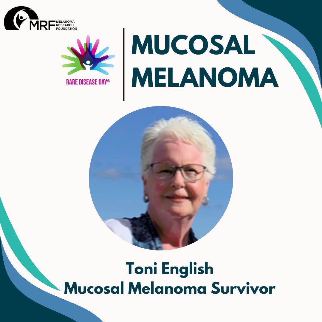CureMelanoma's tweet image. This #RareDiseaseDay learn more about Toni English, a sinonasal mucosal melanoma survivor who was diagnosed in 2015 - buff.ly/3J4robR #OutoftheShadows
