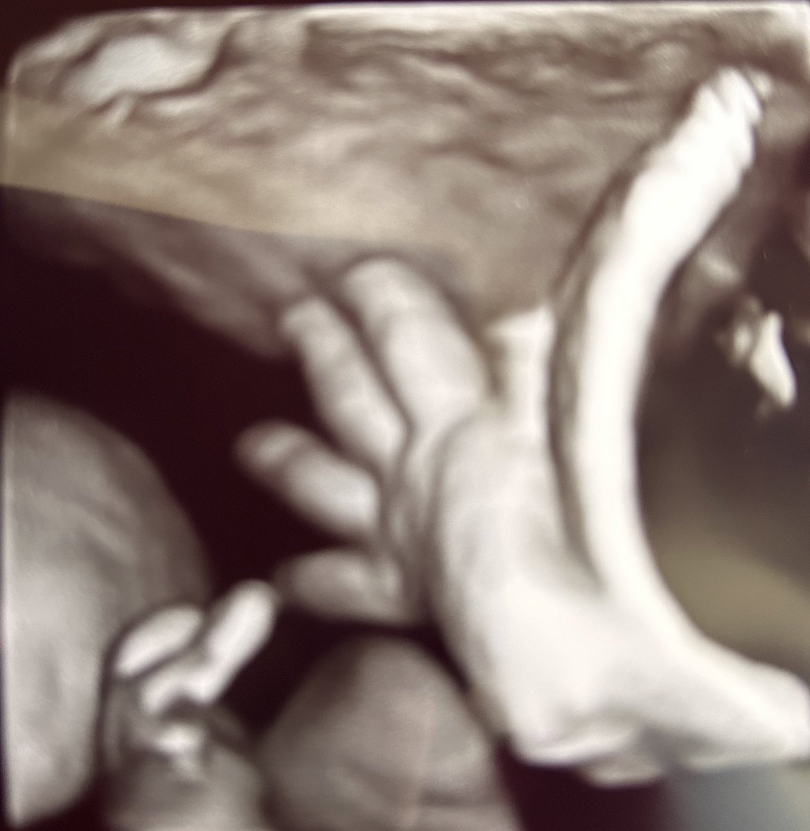 caputante's tweet photo. Süß gelle ☺️ Hab auch tolle Gesichtsbilder von beiden , möchte ich aber nicht teilen auf sozialen Medien . Mädel kommt bereits auf 2,4 kg und der Bub auf 1,8 kg . Für #34SSW ordentlich! #zwillinge #schwangerschaft https://t.co/5XnqWRcT5j