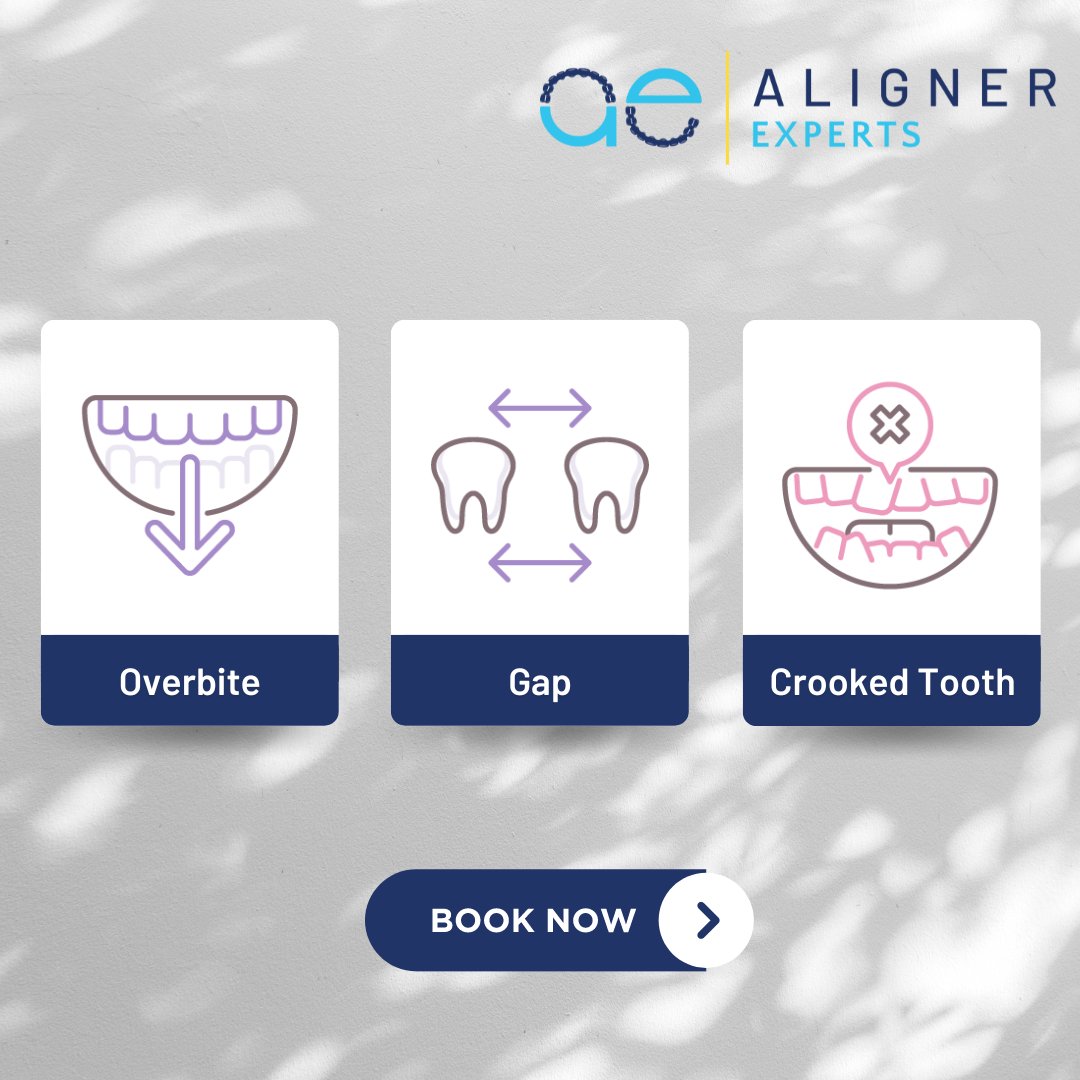 Whether it's a crooked tooth, an overbite or a gap, Aligner Experts can help!

Choose us for advanced solutions and transformative orthodontic care at zurl.co/sElH
#ClearAligners #FixYourSmile #Chicago