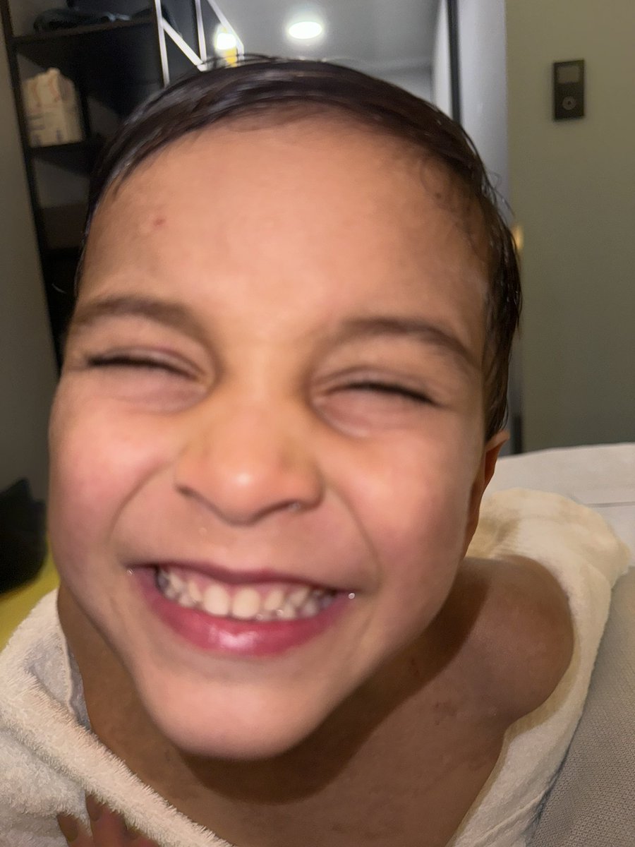 Shining a light on #EpidermolysisBullosa for #RareDiseaseDay and shout out to my #EBWarrior - the sweetest, funniest and strongest boy ❤️❤️